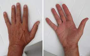 Image Example for hand