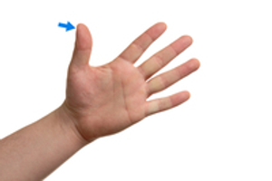 Image Example for thumb