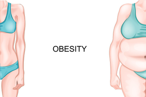 Image Example for obesity