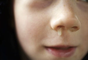 Image Example for runny nose