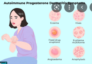 Image Example for allergy