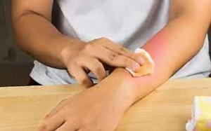 Image Example for mild