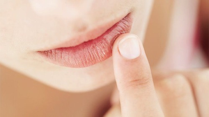 Image Example for chapped lips
