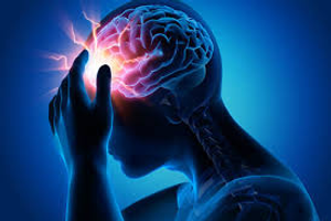 Image Example for migraine