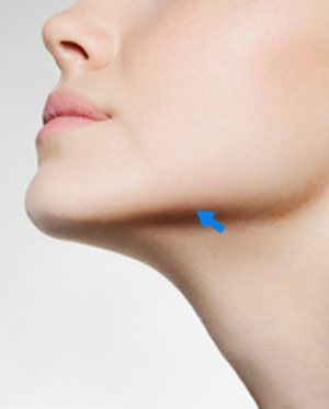 Image Example for jaw